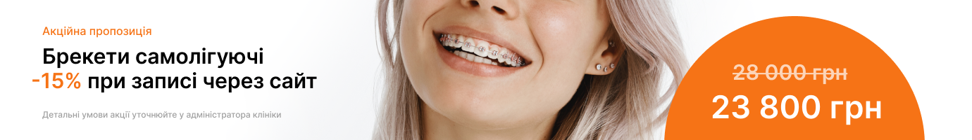 Baner tab breketu