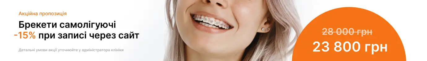 Baner tab breketu