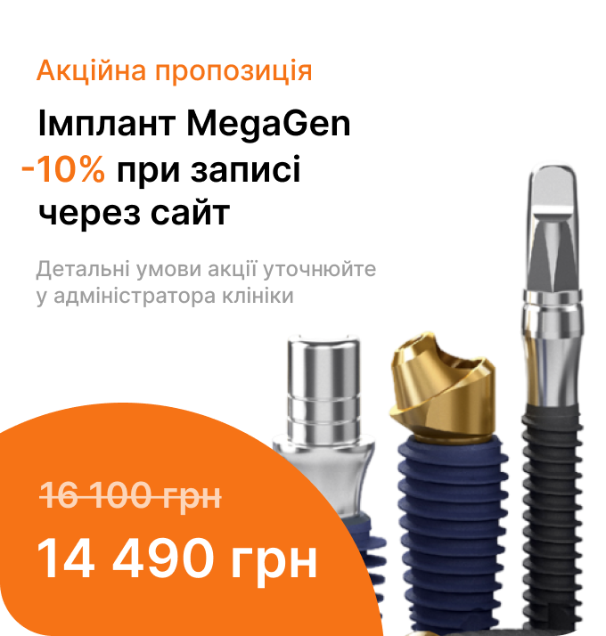Банер Імплантація зубів системою MEGAGen