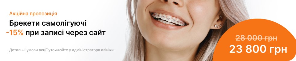 Baner tab breketu