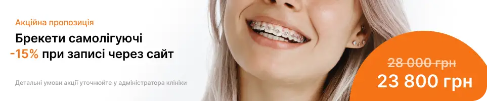 Baner tab breketu
