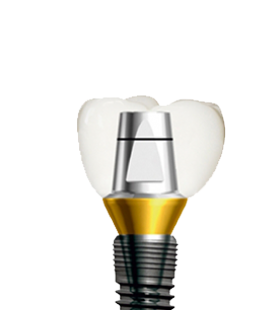 Імплантація зубів системою Dentium Superline