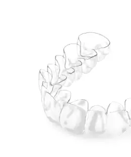 Встановлення елайнерів Invisalign