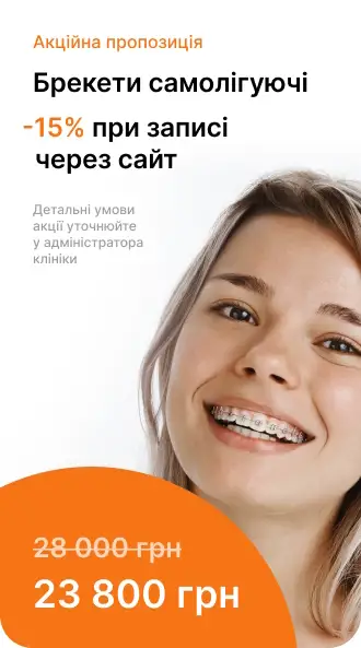 банер