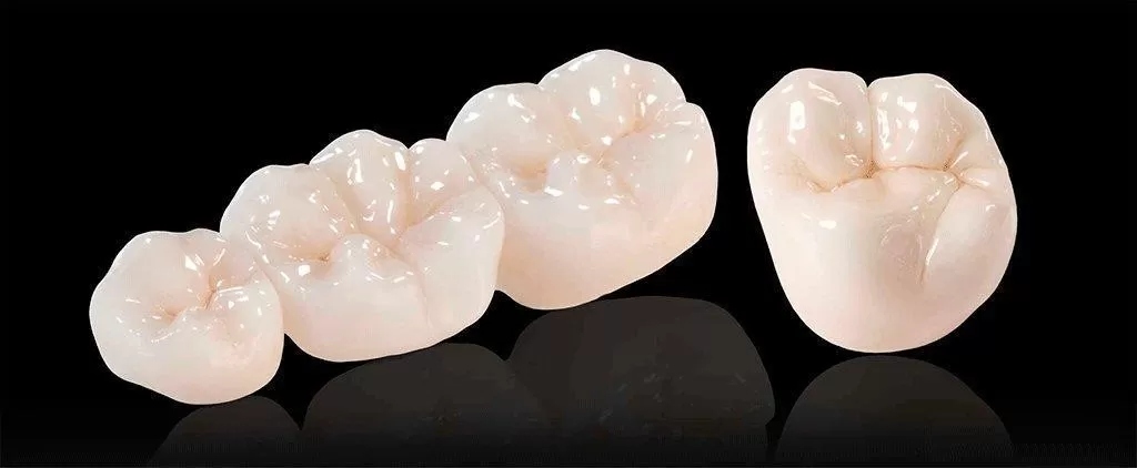 установка коронок из циркония