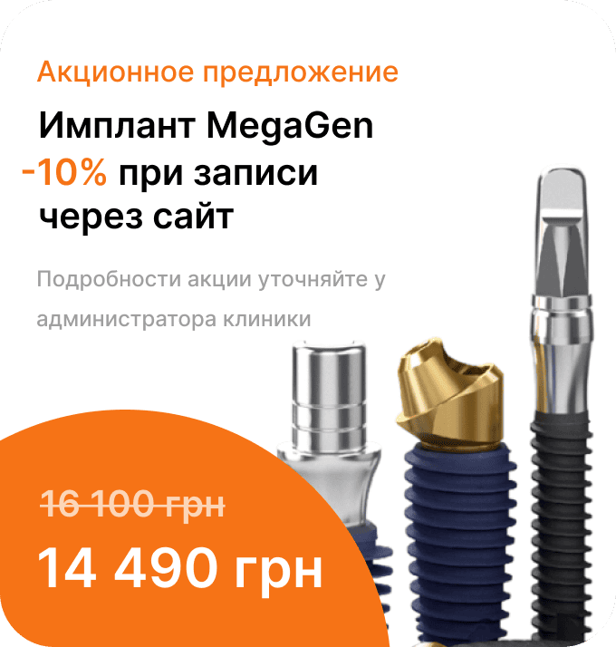 Банер Імплантація зубів системою MEGAGen